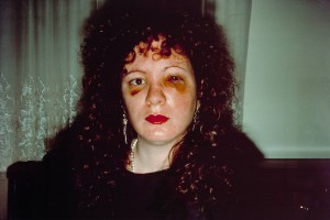 Nan one month after being battered 1984 by Nan Goldin